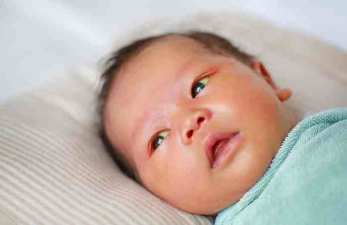 Newborn with jaundice hesi case study