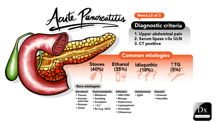 A student learns what information about acute pancreatitis