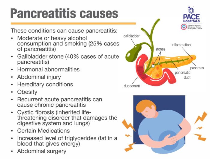 A student learns what information about acute pancreatitis