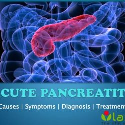 Pancreatitis acute icu