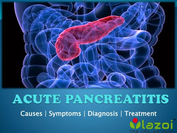 Pancreatitis acute icu